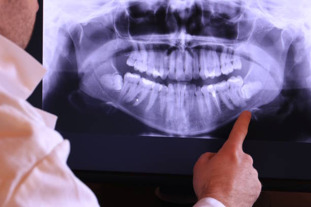 Best Broken or Cracked Tooth Emergency Dentist in Fris, CO